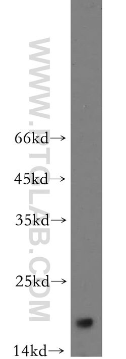 NUDCD2 Rabbit anti-Human, Mouse, Rat, Polyclonal, Proteintech:Antibodies:Primary