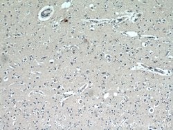 CCDC25 Rabbit anti-Human, Mouse, Rat, Polyclonal, Proteintech:Antibodies:Primary