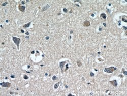 CCDC25 Rabbit anti-Human, Mouse, Rat, Polyclonal, Proteintech:Antibodies:Primary