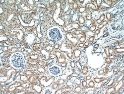 CCDC25 Rabbit anti-Human, Mouse, Rat, Polyclonal, Proteintech:Antibodies:Primary