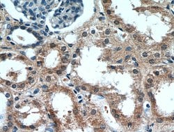 CCDC25 Rabbit anti-Human, Mouse, Rat, Polyclonal, Proteintech:Antibodies:Primary