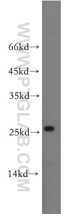 CCDC25 Rabbit anti-Human, Mouse, Rat, Polyclonal, Proteintech:Antibodies:Primary