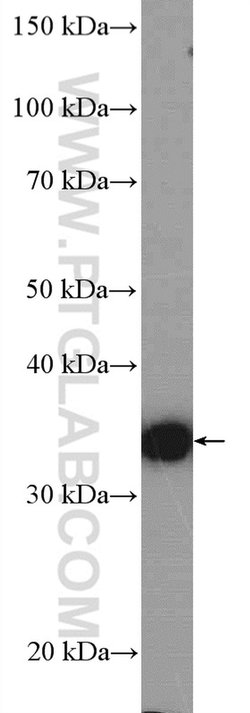 ATOH1 Rabbit anti-Human, Mouse, Rat, Polyclonal, Proteintech:Antibodies:Primary