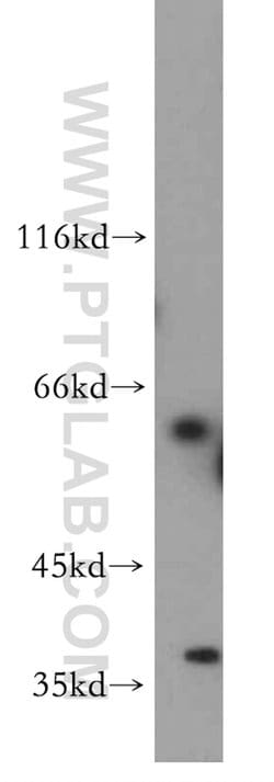 ADAD2 Rabbit anti-Human, Mouse, Rat, Polyclonal, Proteintech 150 &mu;L;