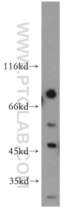 ADAD2 Rabbit anti-Human, Mouse, Rat, Polyclonal, Proteintech 150 &mu;L;