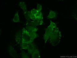 AAMP Rabbit anti-Human, Mouse, Rat, Polyclonal, Proteintech 150 &mu;L;