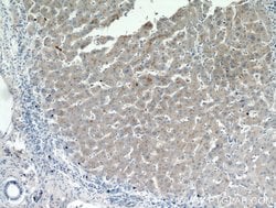 AAMP Rabbit anti-Human, Mouse, Rat, Polyclonal, Proteintech 150 &mu;L;