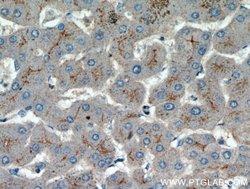 AAMP Rabbit anti-Human, Mouse, Rat, Polyclonal, Proteintech 150 &mu;L;