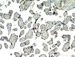 AAMP Rabbit anti-Human, Mouse, Rat, Polyclonal, Proteintech 150 &mu;L;
