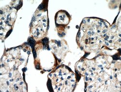 AAMP Rabbit anti-Human, Mouse, Rat, Polyclonal, Proteintech 150 &mu;L;