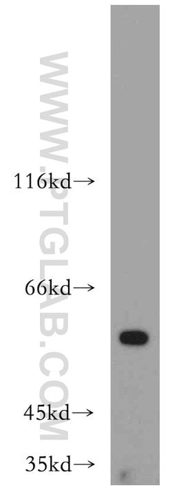 AAMP Rabbit anti-Human, Mouse, Rat, Polyclonal, Proteintech 150 &mu;L;