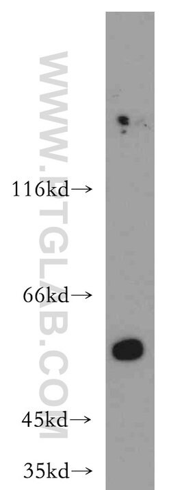 AAMP Rabbit anti-Human, Mouse, Rat, Polyclonal, Proteintech 150 &mu;L;