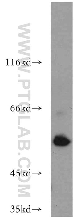 AAMP Rabbit anti-Human, Mouse, Rat, Polyclonal, Proteintech 150 &mu;L;