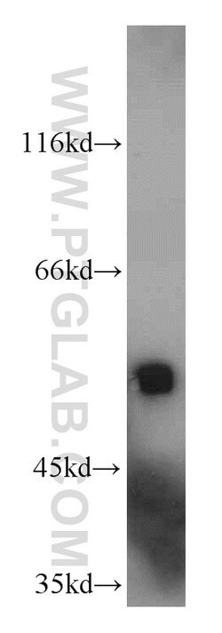 AAMP Rabbit anti-Human, Mouse, Rat, Polyclonal, Proteintech 150 &mu;L;