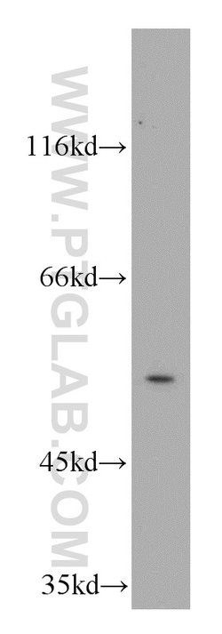 AAMP Rabbit anti-Human, Mouse, Rat, Polyclonal, Proteintech 150 &mu;L;