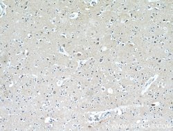 HAPLN4 Rabbit anti-Human, Mouse, Rat, Polyclonal, Proteintech 150 &mu;L | Buy Online | Proteintech Group Inc | Fisher Scientific