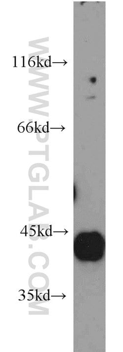 HAPLN4 Rabbit anti-Human, Mouse, Rat, Polyclonal, Proteintech 150 &mu;L | Buy Online | Proteintech Group Inc | Fisher Scientific