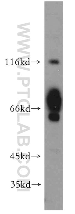 FOXJ3 Rabbit anti-Human, Mouse, Rat, Polyclonal, Proteintech:Antibodies:Primary