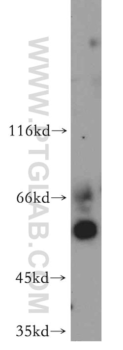 FOXJ3 Rabbit anti-Human, Mouse, Rat, Polyclonal, Proteintech:Antibodies:Primary