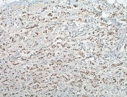 ER Rabbit anti-Human, Mouse, Rat, Polyclonal, Proteintech:Antibodies:Primary