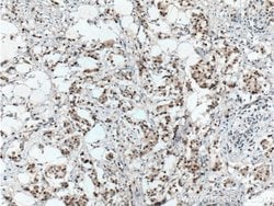 ER Rabbit anti-Human, Mouse, Rat, Polyclonal, Proteintech:Antibodies:Primary