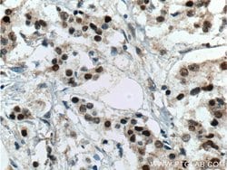 ER Rabbit anti-Human, Mouse, Rat, Polyclonal, Proteintech:Antibodies:Primary