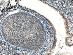 ER Rabbit anti-Human, Mouse, Rat, Polyclonal, Proteintech:Antibodies:Primary