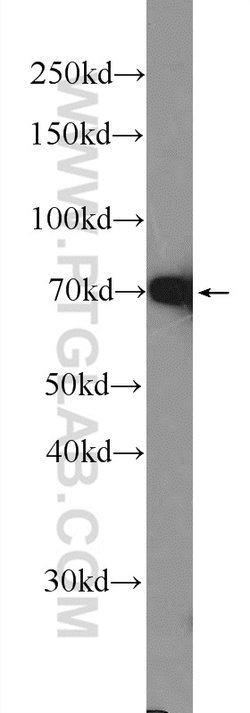 ER Rabbit anti-Human, Mouse, Rat, Polyclonal, Proteintech:Antibodies:Primary