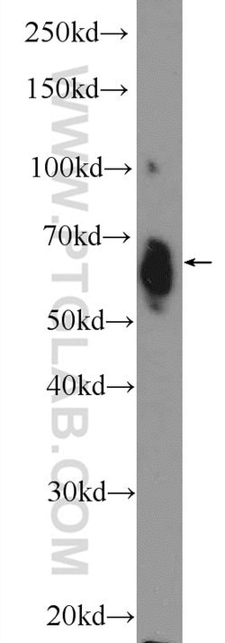 ER Rabbit anti-Human, Mouse, Rat, Polyclonal, Proteintech:Antibodies:Primary