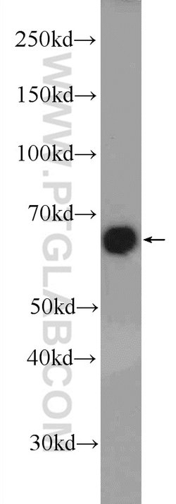 ER Rabbit anti-Human, Mouse, Rat, Polyclonal, Proteintech:Antibodies:Primary