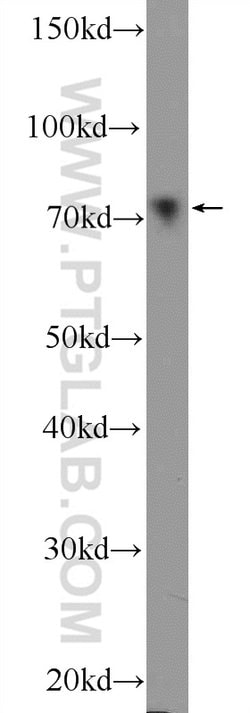 ER Rabbit anti-Human, Mouse, Rat, Polyclonal, Proteintech:Antibodies:Primary