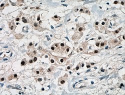 ER Rabbit anti-Human, Mouse, Rat, Polyclonal, Proteintech:Antibodies:Primary