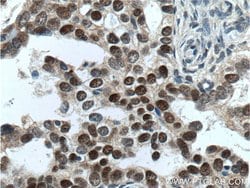 ER Rabbit anti-Human, Mouse, Rat, Polyclonal, Proteintech:Antibodies:Primary