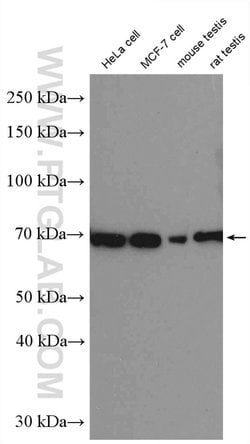 ER Rabbit anti-Human, Mouse, Rat, Polyclonal, Proteintech:Antibodies:Primary