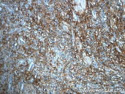 ITIH3 Rabbit anti-Human, Mouse, Rat, Polyclonal, Proteintech 150 &mu;L;