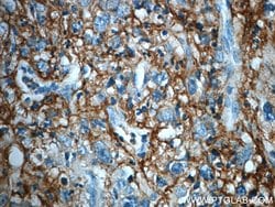 ITIH3 Rabbit anti-Human, Mouse, Rat, Polyclonal, Proteintech 150 &mu;L;