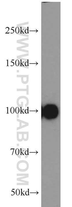 ITIH3 Rabbit anti-Human, Mouse, Rat, Polyclonal, Proteintech 150 &mu;L;
