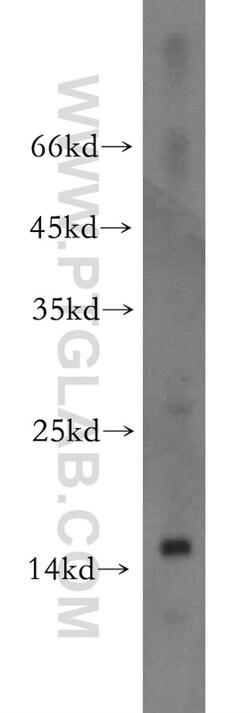 FABP2 Rabbit anti-Human, Mouse, Rat, Polyclonal, Proteintech:Antibodies:Primary