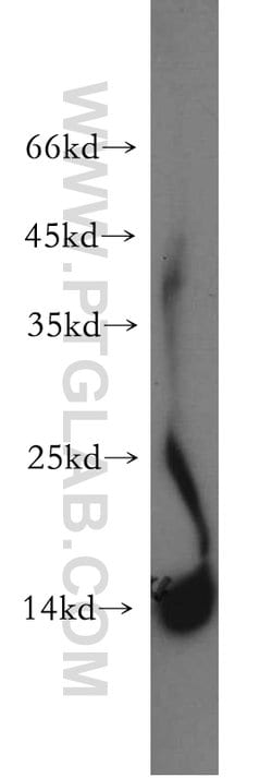 FABP2 Rabbit anti-Human, Mouse, Rat, Polyclonal, Proteintech:Antibodies:Primary