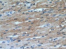 SMYD2 Rabbit anti-Human, Mouse, Polyclonal, Proteintech 150 &mu;L; Unconjugated:Antibodies,