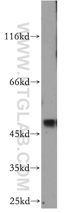 SMYD2 Rabbit anti-Human, Mouse, Polyclonal, Proteintech 150 &mu;L; Unconjugated:Antibodies,