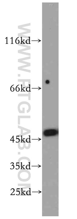 SMYD2 Rabbit anti-Human, Mouse, Polyclonal, Proteintech 150 &mu;L; Unconjugated:Antibodies,