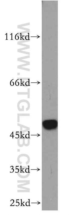 SMYD2 Rabbit anti-Human, Mouse, Polyclonal, Proteintech 150 &mu;L; Unconjugated:Antibodies,