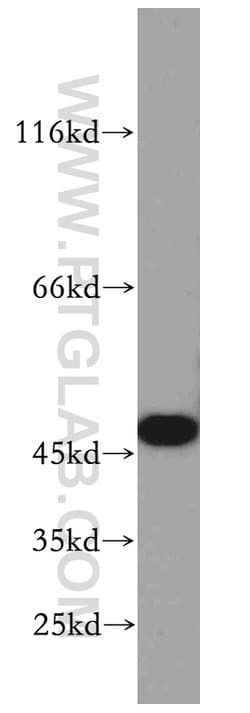 SMYD2 Rabbit anti-Human, Mouse, Polyclonal, Proteintech 150 &mu;L; Unconjugated:Antibodies,