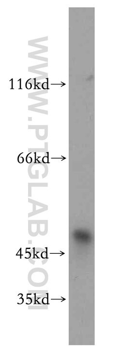 SMYD2 Rabbit anti-Human, Mouse, Polyclonal, Proteintech 150 &mu;L; Unconjugated:Antibodies,