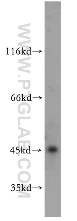 SMYD2 Rabbit anti-Human, Mouse, Polyclonal, Proteintech 150 &mu;L; Unconjugated:Antibodies,