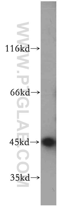 SMYD2 Rabbit anti-Human, Mouse, Polyclonal, Proteintech 150 &mu;L; Unconjugated:Antibodies,
