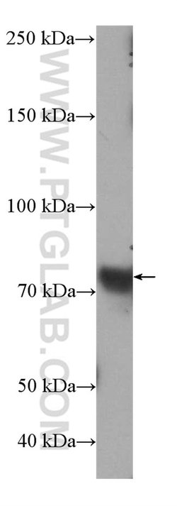 SLC34A2 Rabbit anti-Human, Polyclonal, Proteintech:Antibodies:Primary Antibodies