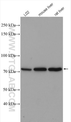 SATB2 Rabbit anti-Human, Mouse, Rat, Polyclonal, Proteintech 20 &mu;L;