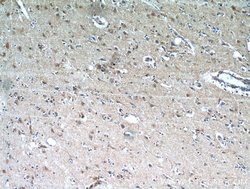 NHLRC1 Rabbit anti-Human, Polyclonal, Proteintech:Antibodies:Primary Antibodies